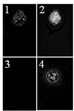 Immunofluorescent detection of p19ARF. MEF cells (1 and 2) or NIH3T3 cells with arf gene deleted (3 and 4) were stained with anti-p19ARF 5C3 followed by a fluorescent-labelled anti-rat IgG (1 and 3) and Hoechst dye to visualise nuclei (2 and 4).