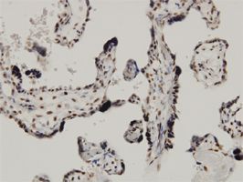 CDKN2AIP antibody (ab57540) used in immunohistochemistry at 3ug/ml on formalin fixed and paraffin embedded human placenta.