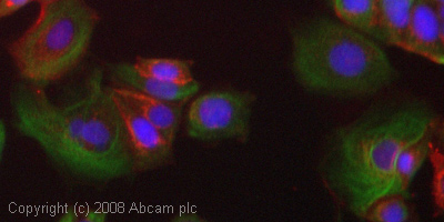 ICC/IF image of ab34189 stained human MCF7 cells. The cells were 4% PFA fixed (10 min), permabilised in 0.1% PBS-Tween (20 min) and incubated with the antibody (ab34189, 1µg/ml) for 1h at room temperature. 1%BSA / 10% normal goat serum / 0.3M glycine was used to block non-specific protein-protein interactions. The secondary antibody (green) was Alexa Fluor® 488 goat anti-rabbit IgG (H+L) used at a 1/1000 dilution for 1h. Alexa Fluor® 594 WGA was used to label plasma membranes (red). DAPI was used to stain the cell nuclei (blue). This antibody also gave a positive IF result in HeLa, HEK 293 and HepG2 cells.  However, this Fast-Track antibody is not yet fully characterised.  This image represents inconclusive preliminary data.