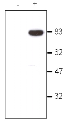 All lanes : Anti-CDYL antibody - ChIP Grade (ab5188) at 1/1000 dilutionLane 1 : COS7 (monkey) cellsLane 2 : COS7 cells transfected with HA-CDYL-FLAG plasmid