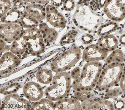 Image courtesy of Human Protein Atlas ab5188 staining CDYL in human male kidney, showing a distinct and strong staining pattern in tubuli and glomeruli cells. Paraffin embedded human skin tissue was incubated with ab5188 (1/1000 dilution) for 30 mins at room temperature. Antigen retrieval was performed by heat induction in citrate buffer pH 6.  ab5188 was tested in a tissue microarray (TMA) containing a wide range of normal and cancer tissues as well as a cell microarray consisting of a range of commonly used, well characterised human cell lines. Further results for this antibody can be found at www.proteinatlas.org.