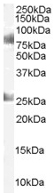 Anti-CDYL antibody (ab3999) at 1 µg/ml + Human Testes lysate (RIPA buffer, 35µg total protein per lane).