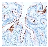 Immunohistochemical staining for CD66a antigen of normal human rectum using ab49510. Note apical membrane staining of absorptive epithelial cells. Paraffin section.