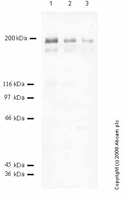 All lanes : Anti-ADAMTS13 antibody (ab60930) at 1/1000 dilutionLane 1 : Recombinant Human ATS-13 at 0.08 µgLane 2 : Recombinant Human ATS-13 at 0.04 µgLane 3 : Recombinant Human ATS-13 at 0.02 µg