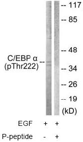 All lanes : Anti-CEBP Alpha (phospho T226) antibody (ab63543) at 1/500 dilutionLane 1 : Extracts from COS7 cells, treated with EGF (200ng/ml, 30mins)Lane 2 : Extracts from COS7 cells, treated with EGF (200ng/ml, 30mins), with immunizing phosphopeptide at 5 µgLysates/proteins at 5 µg per lane.