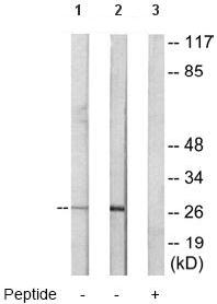 All lanes : Anti-CEBP Delta antibody (ab65081) at 1/500 dilutionLane 1 : Extracts from LOVO cellsLane 2 : Extracts from RAW264.7 cellsLane 3 : Extracts from RAW264.7 cells with immunising peptide at 10 µgLysates/proteins at 30 µg per lane.