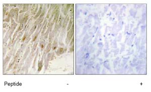 Immunohistochemistry analysis of paraffin-embedded human heart tissue using ab74045, at 1/50 dilution, in the presence (right panel) or absence (left panel) of immunising peptide.