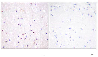 ab59422, at a 1/50 dilution, staining paraffin embedded human brain tissue sections by Immunohistochemistry in the absence (left image) or presence (right image) of the phosphopeptide.
