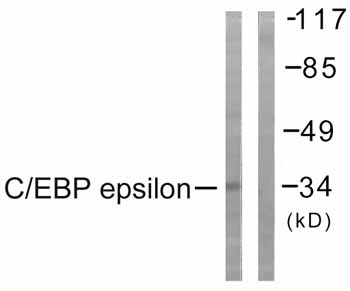 Immunohistochemistry analysis of paraffin-embedded human brain tissue using ab59384 at a 1/50 dilution.Left image un-treated.Right image treated with peptide.