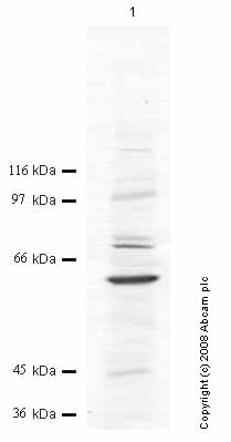 Anti-ADAMTS17 antibody (ab45049) at 1/1000 dilution + Whole cell lysate prepared from A2058 human melanoma cancer cells