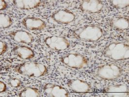 Cellular Apoptosis Susceptibility antibody (ab54674) used in immunohistochemistry at 3ug/ml on formalin fixed and paraffin embedded human colon.