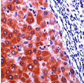 Ab27519, prediluted, staining Cellular Apoptosis Susceptibility in formalin fixed paraffin embedded sections by Immunohistochemistry.