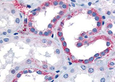 Immunohistochemical analysis of formalin-fixed and paraffin embedded Human kidney tissue labeling CELSR1 in distal convoluted tubules and proximal convoluted tubules, using ab150574 at 10 ug/ml
