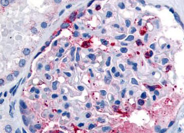 Immunohistochemical analysis of formalin-fixed and paraffin embedded Human kidney tissue labeling CELSR1 in glomerulus using ab150574 at 10 ug/ml