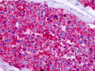 Immunohistochemical analysis of formalin-fixed and paraffin embedded Human testis tissue labeling CELSR1 with ab150574 at 10 ug/ml