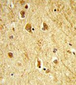 Immunohistochemical analysis of formalin-fixed, paraffin-embedded Human brain tissue labelling ADAMTS18 with ab135728 at 1/150 dilution, followed by peroxidase-conjugated secondary antibody and DAB staining.