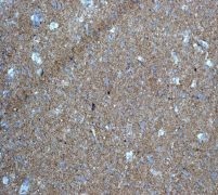 ab113076 at 1/500 dilution, staining CEND1 in Praffin-embedded Human brain tissue by Immunohistochemistry.