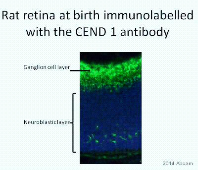 ab113076 staining CEND1 in Rat retina (at birth) tissue sections by Immunohistochemistry (IHC-Fr - frozen sections). Tissue was fixed with formaldehyde, permeabilized with 0.1% Triton and blocked with 10% serum for 30 minutes at 22°C. Samples were incubated with primary antibody (1/1000) for 24 hours. An Alexa Fluor® 488-conjugated goat anti-rabbit IgG polyclonal (1/200) was used as the secondary antibody.See Abreview
