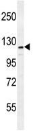 Anti-ADAMTS18 antibody - C-terminal (ab135728) at 1/100 dilution + MDA-MB231 cell line lysate at 35 µg