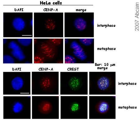 ab13939 staining CENPA by Immunofluorescence. This antibody works very well in HeLa cells, with double staining of kinetochores using CREST indicating perfect co-localization. Optimal antibody dilution: 2mg/ml.Optimal fixation protocol: PFA fixation: 10 min in 3,7 % PFA  at room temperature, 5 min in PBS / 0,1%Triton X-100,  then 3 washes in PBS.Also works well after PFA/Methanol fixation: 10 min in 3,7% PFA Troom, 1 wash in PBS, MetOH 20 min, -20°C, then 3 washes in PBS.IF staining was performed following a standard protocol:  blocking: 30 min; primary antibody: 1 hr; secondary antibody: 45 min. All incubations were at 37 °C in PBS/ 0,1% Tween containing 3% BSA.