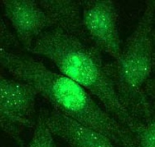 Immunofluorescent staining of HeLa cells using ab45694 (1:250).