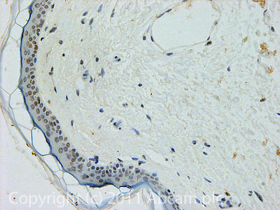 IHC image of ab45694 staining CENPA in Human skin formalin fixed paraffin embedded tissue section, performed on a Leica BondTM system using the standard protocol F. The section was pre-treated using heat mediated antigen retrieval with sodium citrate buffer (pH6, epitope retrieval solution 1) for 20 mins. The section was then incubated with ab45694, 10µg/ml, for 15 mins at room temperature and detected using an HRP conjugated compact polymer system. DAB was used as the chromogen. The section was then counterstained with haematoxylin and mounted with DPX.For other IHC staining systems (automated and non-automated) customers should optimize variable parameters such as antigen retrieval conditions, primary antibody concentration and antibody incubation times.