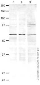 All lanes : Anti-CENPB antibody (ab25734) at 1 µg/mlLane 1 : HeLa (Human epithelial carcinoma cell line) Whole Cell Lysate Lane 2 : Jurkat (Human T cell lymphoblast-like cell line) Whole Cell Lysate (ab7899)Lane 3 : A431 (Human epithelial carcinoma cell line) Whole Cell Lysate (ab7909)Lysates/proteins at 20 µg per lane.SecondaryGoat polyclonal to Rabbit IgG (Alexa Fluor® 680) at 1/10000 dilutiondeveloped using the ECL technique