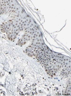  Image courtesy of Human Protein Atlas. ab25734 staining CENPB in Human skin, showing nuclear staining in the epidermis and dermal layer. Paraffin embedded human skin tissue was incubated with ab25734(1/100 dilution) for 30 mins at room temperature. Antigen retrieval was performed by heat induction in citrate buffer pH 6. ab25734 was tested in a tissue microarray (TMA) containing a wide range of normal and cancer tissues. Further results for this antibody can be found at www.proteinatlas.org