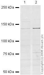 All lanes : Anti-CENPC antibody (ab33034) at 1 µg/mlLane 1 : HeLa (Human epithelial carcinoma cell line) Whole Cell Lysate at 10 µgLane 2 : Jurkat (Human T cell lymphoblast-like cell line) Whole Cell Lysate (ab7899) at 20 µgSecondaryIR Dye 680 Conjugated Goat Anti-Rabbit IgG (H+L) at 1/15000 dilutionPerformed under reducing conditions.