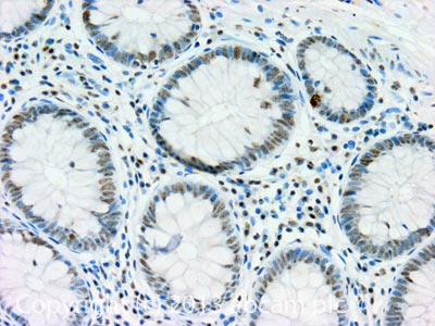 IHC image of CENPF staining in Human normal colon formalin fixed paraffin embedded tissue section, performed on a Leica BondTM system using the standard protocol F. The section was pre-treated using heat mediated antigen retrieval with sodium citrate buffer (pH6, epitope retrieval solution 1) for 20 mins. The section was then incubated with ab108483, 1µg/ml, for 15 mins at room temperature and detected using an HRP conjugated compact polymer system. DAB was used as the chromogen. The section was then counterstained with haematoxylin and mounted with DPX. For other IHC staining systems (automated and non-automated) customers should optimize variable parameters such as antigen retrieval conditions, primary antibody concentration and antibody incubation times.
