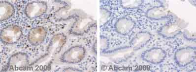Ab5 staining Human normal colon tissue. Staining is localised to nuclear compartment.Left panel: with primary antibody at 4 ug/ml. Right panel: isotype control.Sections were stained using an automated system DAKO Autostainer Plus , at room temperature: sections were rehydrated and antigen retrieved with the Dako 3 in 1 AR buffer EDTA pH 9.0 in a DAKO PT Link. Slides were peroxidase blocked in 3% H2O2 in methanol for 10 mins. They were then blocked with Dako Protein block for 10 minutes (containing casein 0.25% in PBS) then incubated with primary antibody for 20 min and detected with Dako envision flex amplification kit for 30 minutes. Colorimetric detection was completed with Diaminobenzidine for 5 minutes. Slides were counterstained with Haematoxylin and coverslipped under DePeX. Please note that for manual staining we recommend to optimize the primary antibody concentration and incubation time (overnight incubation), and amplification may be required.