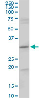 Anti-CENPH antibody (ab88593) at 5 µg/ml + NIH/3T3 cell lysate at 25 µgdeveloped using the ECL technique