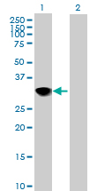 All lanes : Anti-CENPH antibody (ab88593) at 5 µg/mlLane 1 : cell lysate from CENPH transfected 293T cellsLane 2 : cell lysate from non transfected 293T cellsLysates/proteins at 25 µg per lane.developed using the ECL technique