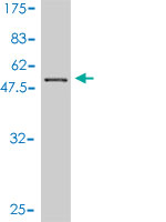 Western blot against tagged recombinant protein immunogen using ab57660 BM039 antibody at 1ug/ml.