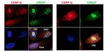 Immunofluorescence microscopy using ab105742 shows detection of endogenous CENPQ in HeLa whole cell lysate. Primary antibody was used at 1:100 followed by secondary antibody diluted 1:150. Red punctate anti-CENPQ signal colocalizes in overlay images with green punctate anti-CREST signals at the kinetochores (attached points of sister chromatids). Visible are colocalized CENPQ and CREST signal at various stages of the cell cycle as indicated from interphase to the end of mitosis. Nuclei are counter stained with bisbenzimide.