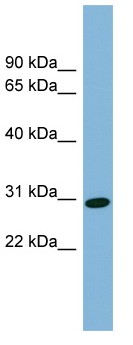 Anti-CENPQ antibody (ab98973) at 1 µg/ml + fetal liver lysate at 10 µg