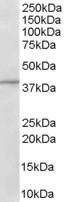Anti-Centaurin alpha 1 antibody (ab27476) at 1 µg/ml + Human Brain lysate (35µg protein in RIPA buffer). 