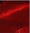 Immunofluorescence image of CEP104 in rat brain tissue using ab28773.
