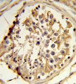 Immunohistochemical analysis of formalin-fixed paraffin-embedded Human testis tissue, labeling CEP128 using ab175959 at a 1/50 dilution, followed by peroxidase conjugation of the secondary antibody and DAB staining.