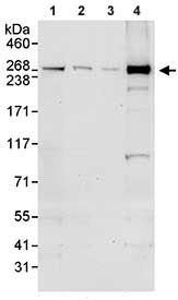 All lanes : Anti-CEP290 antibody (ab85728) at 0.1 µg/mlLane 1 : Whole cell lysate from HeLa cells at 50 µgLane 2 : Whole cell lysate from HeLa cells at 15 µgLane 3 : Whole cell lysate from HeLa cells at 5 µgLane 4 : Whole cell lysate from 293T cells at 50 µgdeveloped using the ECL technique