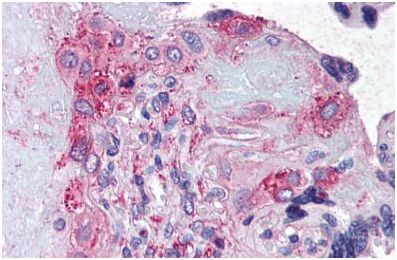Immunohistochemical analysis of formalin-fixed, paraffin-embedded Human placenta tissue (after heat induced antigen retrieval) labelling ADAMTS5 with ab140695 at 20 µg/ml.