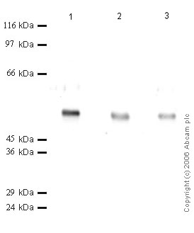 All lanes : Anti-ADAMTS5 antibody - Catalytic domain (ab50749) at 1/1000 dilutionLane 1 : rH-ADAMTS-5 Catalytic Domain at 0.1 µgLane 2 : rH-ADAMTS-5 Catalytic Domain at 0.04 µgLane 3 : rH-ADAMTS-5 Catalytic Domain at 0.02 µg