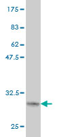 Western blot against tagged recombinant protein immunogen using ab56992 LASS1 antibody at 1ug/ml.