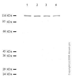 All lanes : Anti-ADAMTS6 antibody (ab50647) at 1/1000 dilutionLane 1 : Cell media from human amnion-derived WISH cells (treated with IL1-beta) at 12 µlLane 2 : Cell media from human amnion-derived WISH cells (treated with IL1-beta) at 10 µlLane 3 : Cell media from human amnion-derived WISH cells (treated with IL1-beta) at 8 µlLane 4 : Cell media from human amnion-derived WISH cells (treated with IL1-beta) at 6 µl
