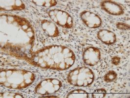 CES2 antibody (ab56528) used in immunohistochemistry at 3ug/ml on formalin fixed and paraffin embedded human colon.