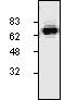 Anti-CETP antibody (ab19012)