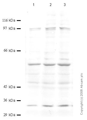 All lanes : Anti-ADAMTS8 antibody (ab59822) at 1/1000 dilutionLane 1 : Whole cell lysate prepared from human epithelial carcinoma A-431 cells (treated with SF)Lane 2 : Whole cell lysate prepared from human epithelial carcinoma A-431 cells (treated with TPA)Lane 3 : Whole cell lysate prepared from human epithelial carcinoma A-431 cells (treated with IL1-beta)Lysates/proteins at 20 µl per lane.