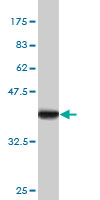 Western blot against tagged recombinant protein immunogen (0.2ug/ lane) using ab56714 CFDP1 antibody at 1ug/ml. Detected band size in image is ~40kDa.