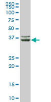 Anti-CFHL1 antibody (ab67190) at 1/500 dilution + human liver tissue lysate at 25 µg/mlSecondaryGoat Anti-Mouse IgG (H&L)-HRP Conjugate at 1/2500 dilution