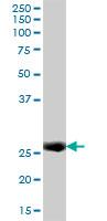 Anti- IFI30 antibody (ab70510) at 1/500 dilution + Human spleen tissue lysate at 25 µgSecondaryGoat Anti-Mouse IgG (H&L)-HRP Conjugate at 1/2500 dilution